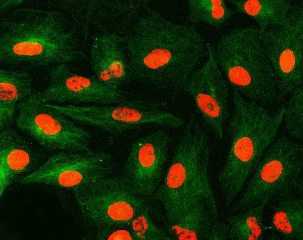 a08780 2 snrpa primary antibodies if testing 20