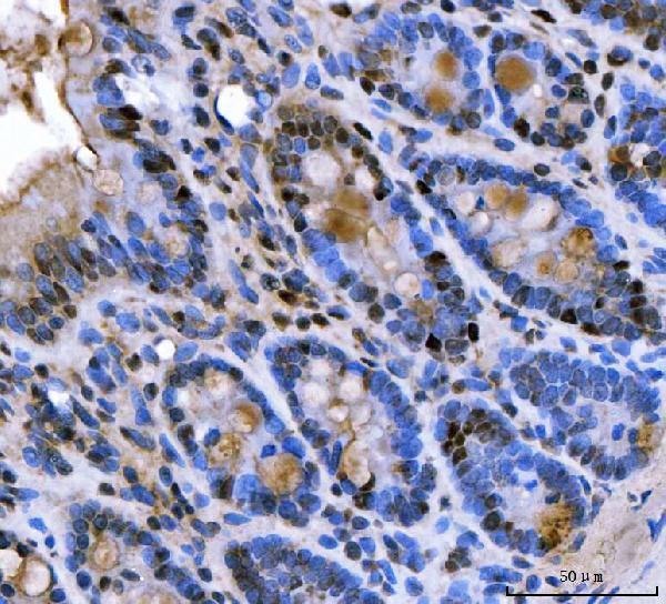 a08780 2 snrpa primary antibodies ihc testing 18