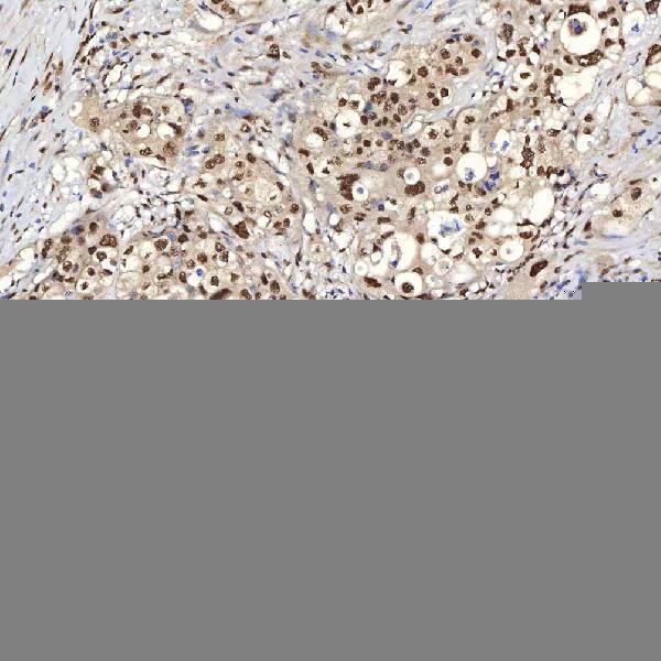  IHC analysis of U1A/SNRPA using anti-U1A/SNRPA antibody (A08780-2)