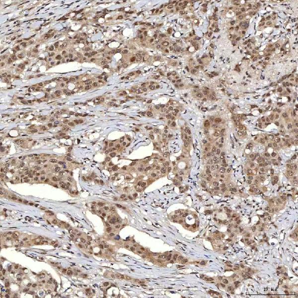  IHC analysis of U1A/SNRPA using anti-U1A/SNRPA antibody (A08780-2)