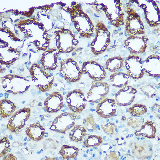 Immunohistochemistry of paraffin-embedded rat kidney using UQCRFS1 Rabbit pAb  at dilution of 1:100 