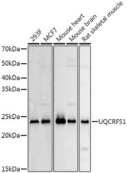 Western blot analysis of extracts of various cell lines, using UQCRFS1 Rabbit pAb antibody  at 1:500 dilution