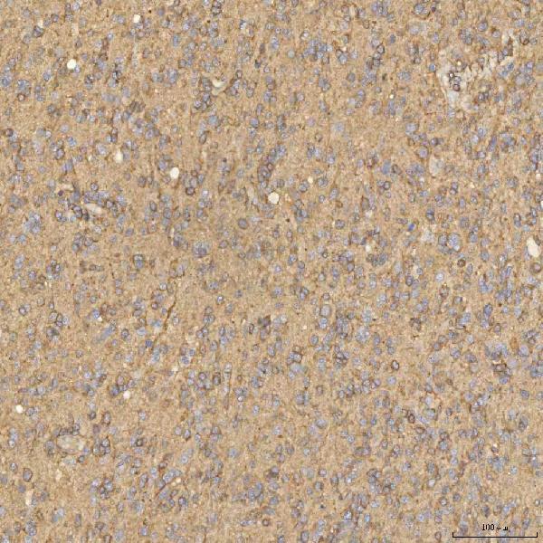  IHC analysis of SNX4 using anti-SNX4 antibody (A08783-2)