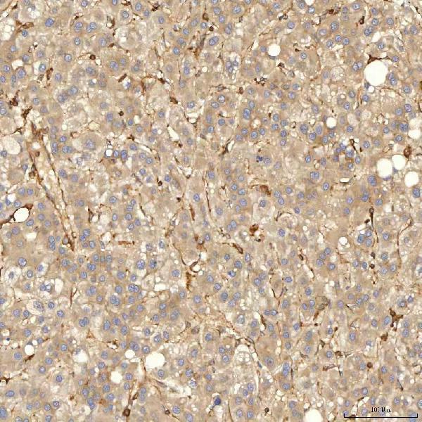  IHC analysis of SNX4 using anti-SNX4 antibody (A08783-2)