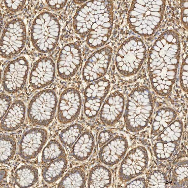 a08783 2 snx4 primary antibodies ihc testing 5