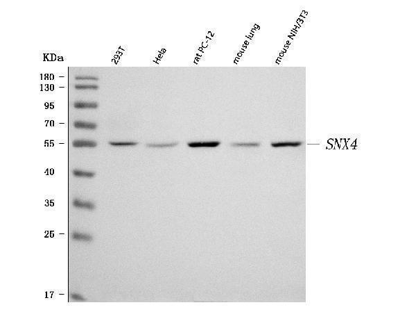  Western blot analysis of SNX4 using anti-SNX4 antibody (A08783-2)