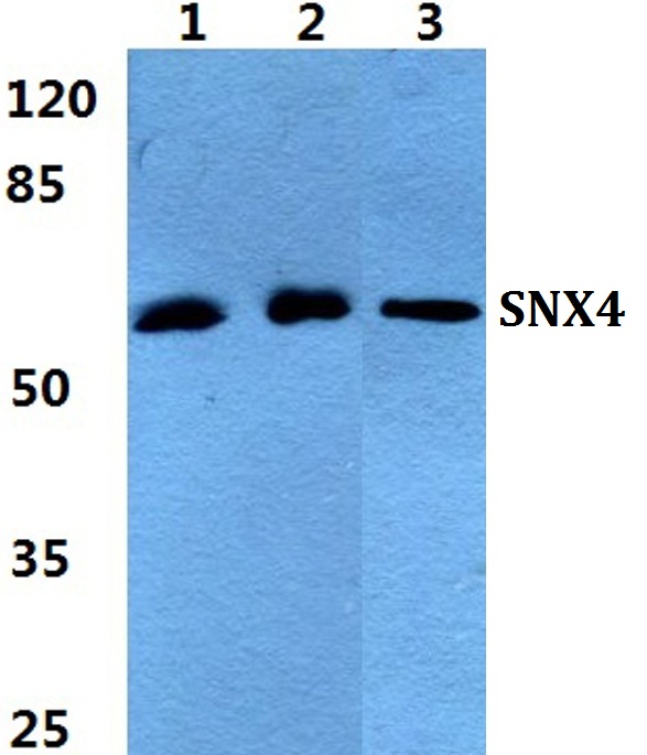 a08783 snx4 primary antiboties wb testing 1