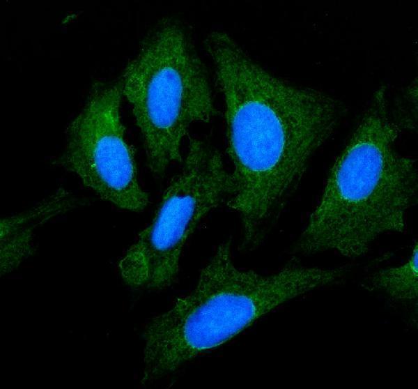 a08789 1 myl1 primary antibodies if testing 1