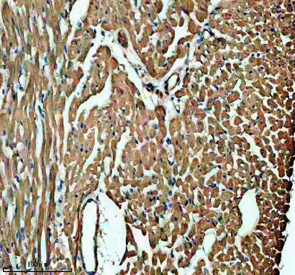 IHC analysis of MYL1 using anti-MYL1 antibody (A08789-1)
