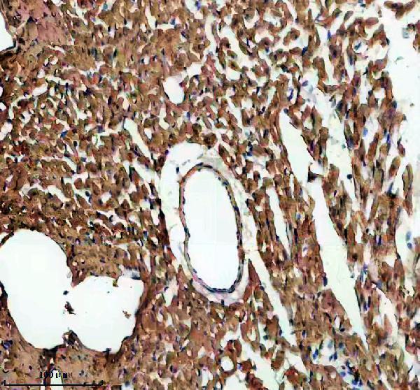 IHC analysis of MYL1 using anti-MYL1 antibody (A08789-1)