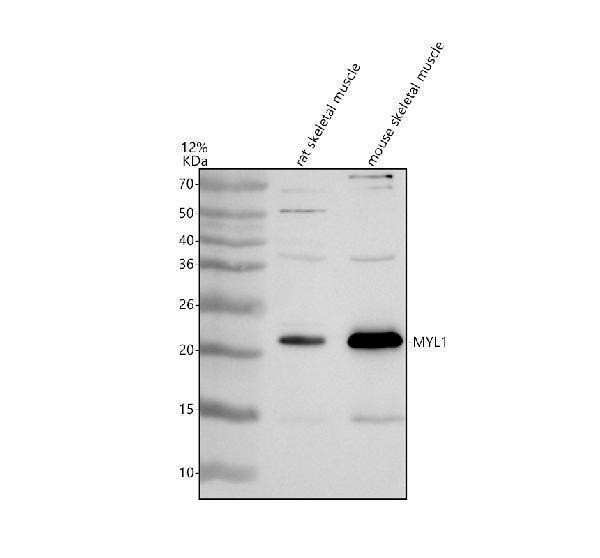 Western blot analysis of MYL1 using anti-MYL1 antibody (A08789-1)