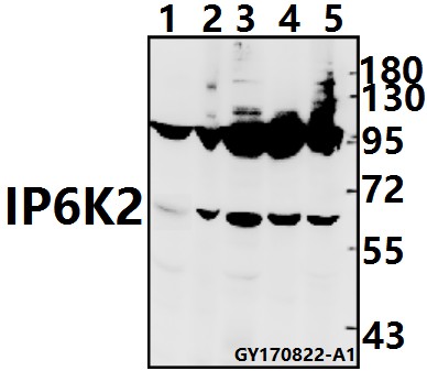 Western blot (WB) analysis of IP6K2 (L188) pAb at 1:500 dilution
Lane1:CT26 whole cell lysate(40ug)
Lane2:C6 whole cell lysate(40ug)
Lane3:Panc1 whole cell lysate(40ug)
Lane4:HCT116 whole cell lysate(40ug)
Lane5:A549 whole cell lysate(40ug)