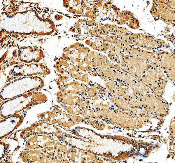a08792 2 ip6k2 primary antibodies ihc testing 1