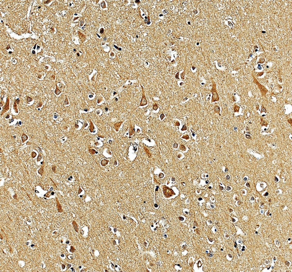 a08792 2 ip6k2 primary antibodies ihc testing 2