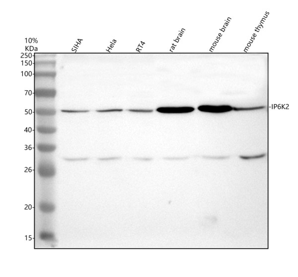 a08792 2 ip6k2 primary antibodies wb testing 1
