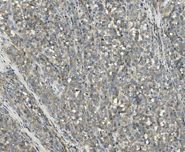 a08794 ppm1e primary antibodies ihc testing 2