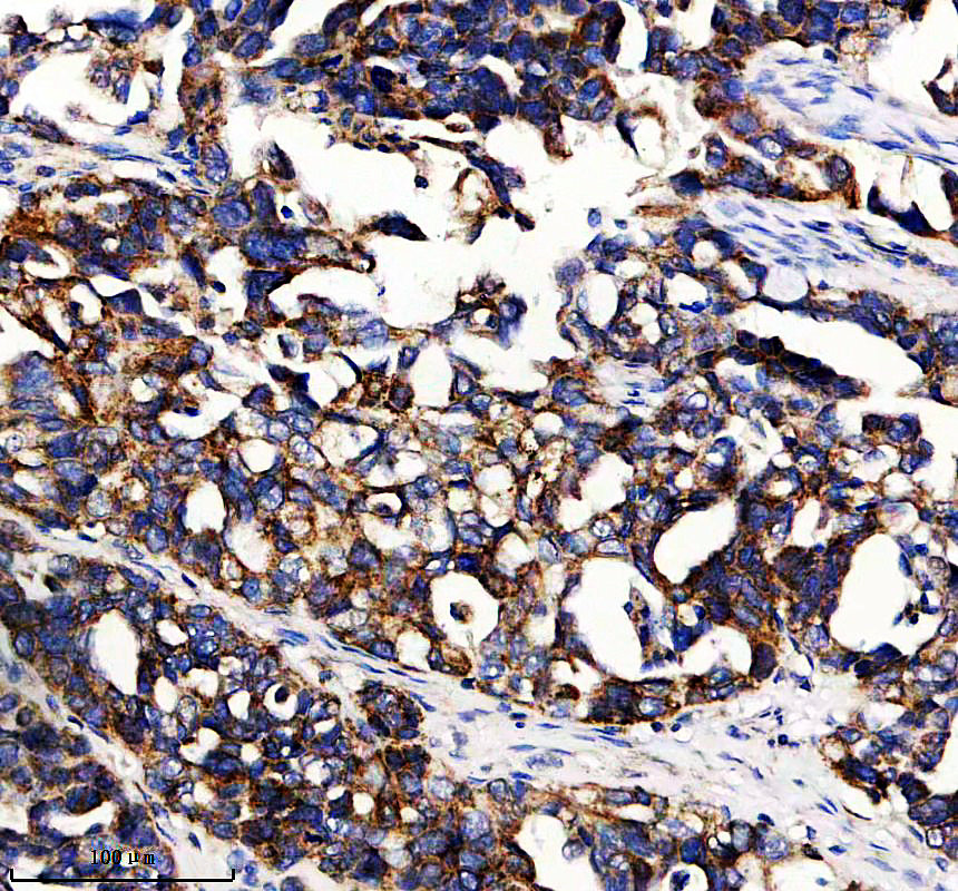IHC analysis of KCNJ12/18 using anti-KCNJ12/18 antibody (A08795-1)
