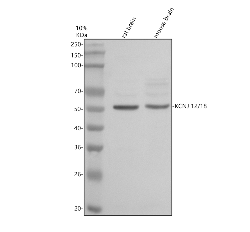 Western blot analysis of KCNJ12/18 using anti-KCNJ12/18 antibody (A08795-1)