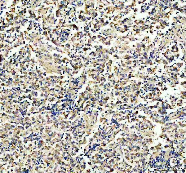 a08797 2 faf2 primary antibodies ihc testing 3