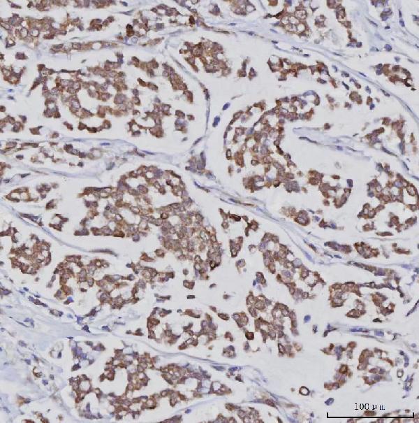 a08798 1 plxdc2 primary antibodies ihc testing 2
