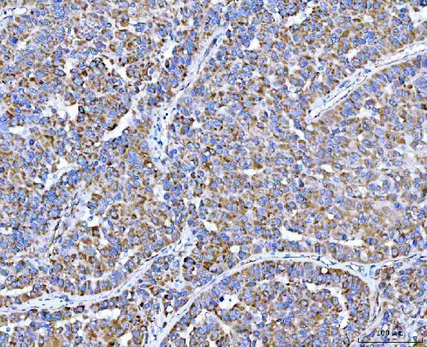 a08798 1 plxdc2 primary antibodies ihc testing 3