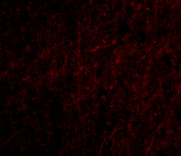 a08798 plxdc2 primary antibodies if testing 3
