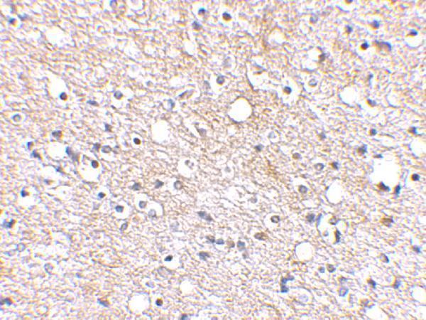 a08798 plxdc2 primary antibodies ihc testing 2