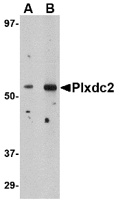 a08798 plxdc2 primary antibodies wb testing 1