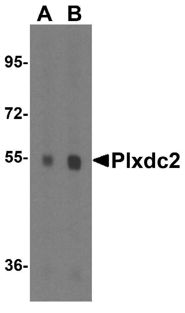 a08798 plxdc2 primary antibodies wb testing 4
