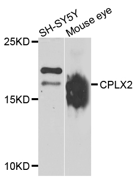 Western blot analysis of extracts of various cell lines, using CPLX2 antibody