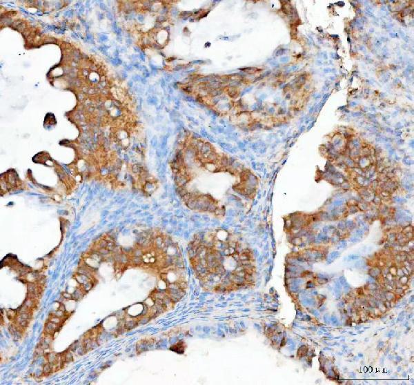 a08801 1 rhot2 primary antibodies ihc testing 3