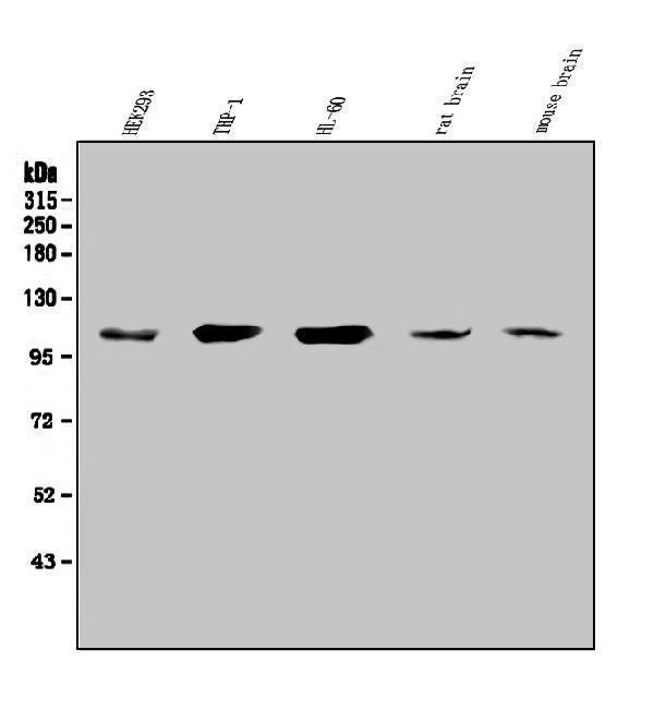  Western blot analysis of SEZ6L using anti-SEZ6L antibody (A08803-1)