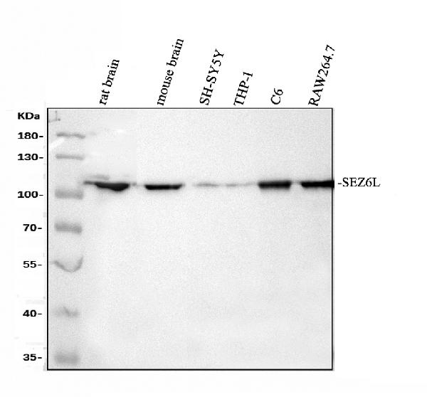 Western blot analysis of SEZ6L using anti-SEZ6L antibody (A08803-1)