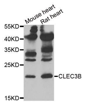 WesternBlot (WB) analysis of CLEC3B polyclonal antibody