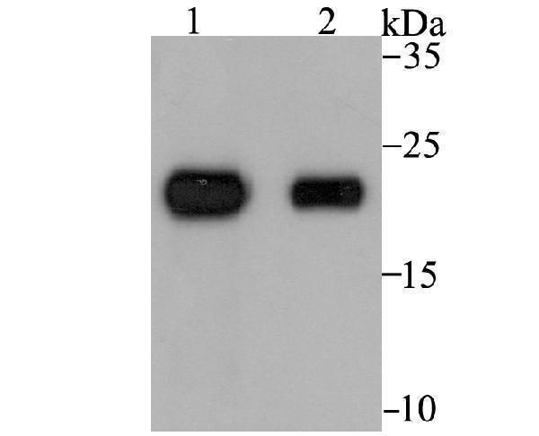 Western blot analysis of Tetranectin on rat skin (1) and human skin (2) tissue lysates using anti-Tetranectin antibody at 1/1,000 dilution