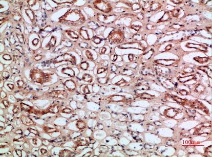 Immunohistochemical analysis of paraffin-embedded human-kidney, antibody was diluted at 1:200