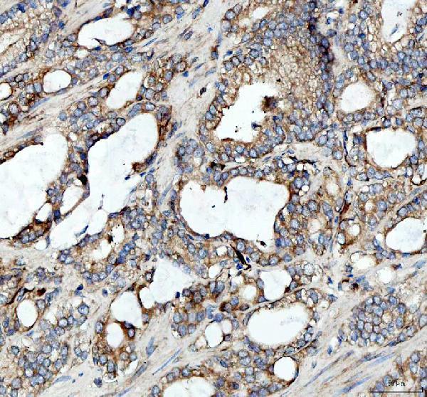 IHC analysis of AP2A1 using anti-AP2A1 antibody (A08806-1)