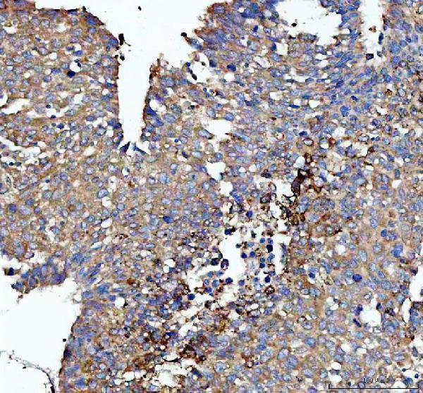 IHC analysis of AP2A1 using anti-AP2A1 antibody (A08806-1)