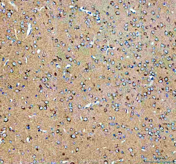 a08806 1 ap2a1 primary antibodies ihc testing 3