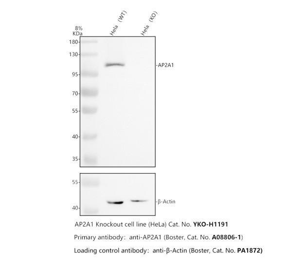 Western blot analysis of AP2A1 using anti-AP2A1 antibody (A08806-1)