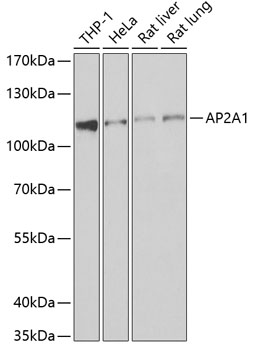 Western blot analysis of extracts of various cell lines, using AP2A1 antibody  at 1:1000 dilution