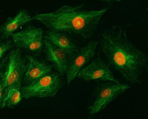 a08807 1 snrpg primary antibodies if testing 1