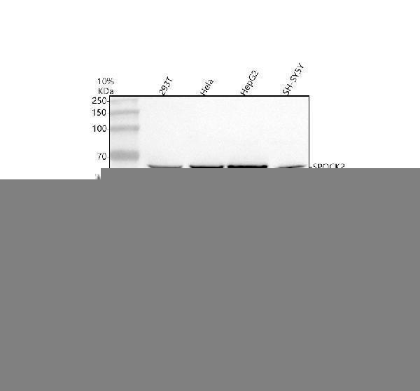  Western blot analysis of SPOCK2 using anti-SPOCK2 antibody (A08811-1)