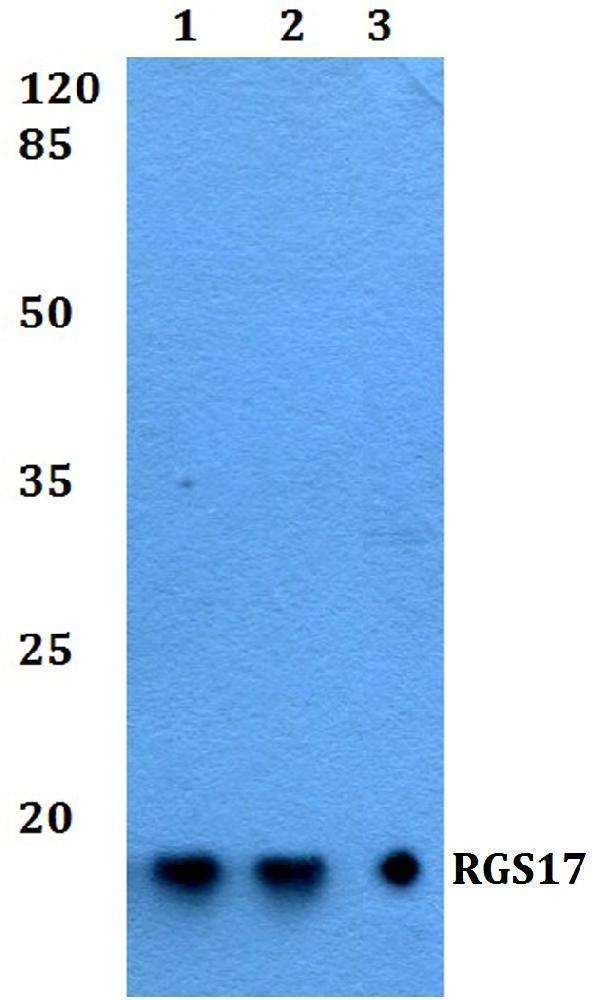 Western blot (WB) analysis of RGS17 polyclonal antibody at 1:500 dilution
Lane1:HEK293T whole cell lysate
Lane2:Raw264