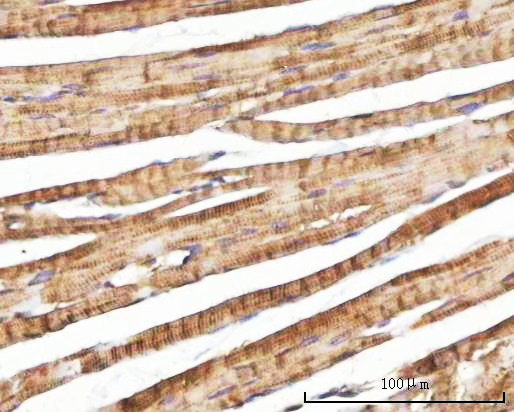  IHC analysis of NEBL using anti-NEBL antibody (A08817-2)