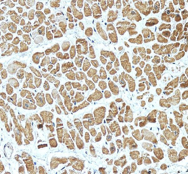 IHC analysis of NEBL using anti-NEBL antibody (A08817-2)