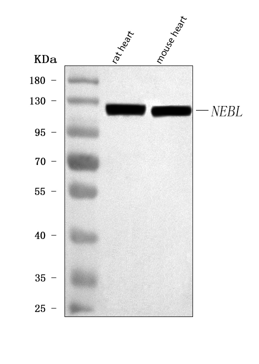  Western blot analysis of NEBL using anti-NEBL antibody (A08817-2)