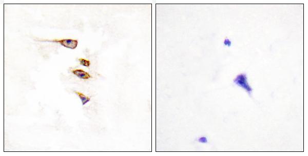 Immunohistochemistry analysis of paraffin-embedded human brain tissue, using EPHA6 Antibody