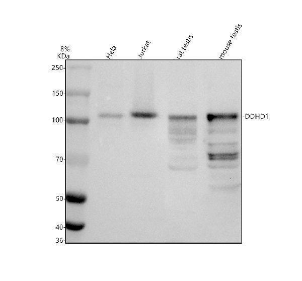 Western blot analysis of DDHD1 using anti-DDHD1 antibody (A08820)