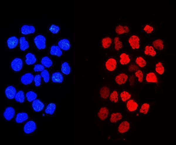 a08821 1 h1f0 primary antibodies if testing 12